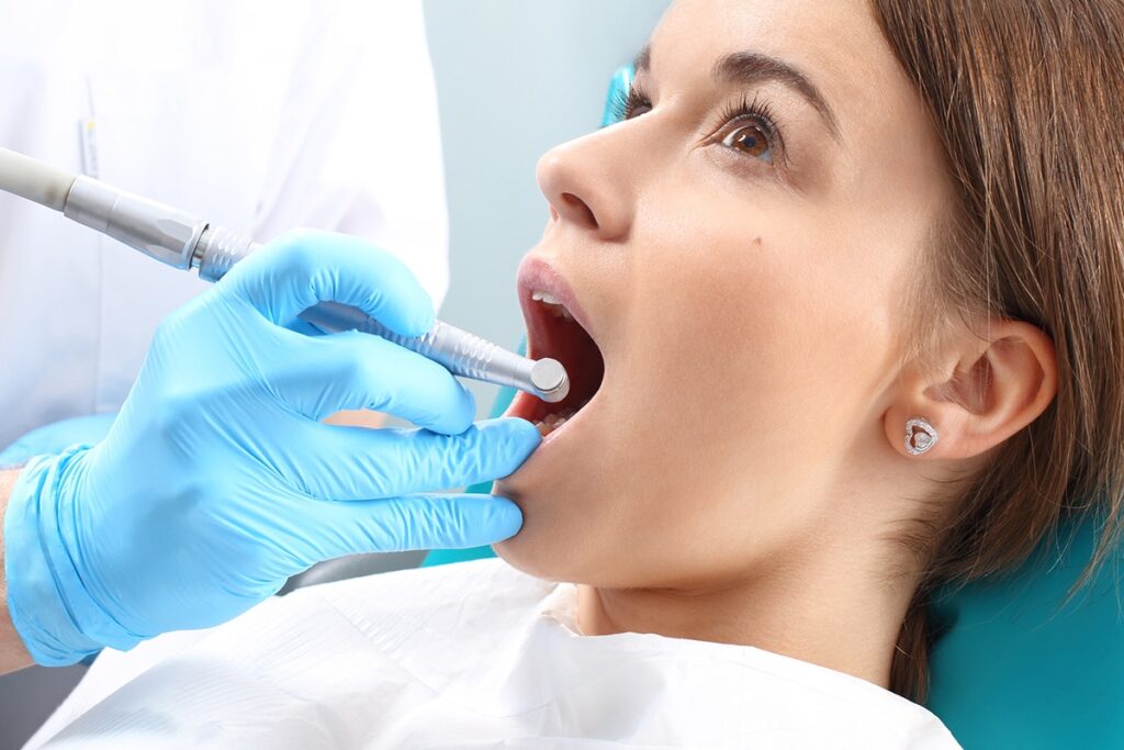 3 Myths About Root Canals