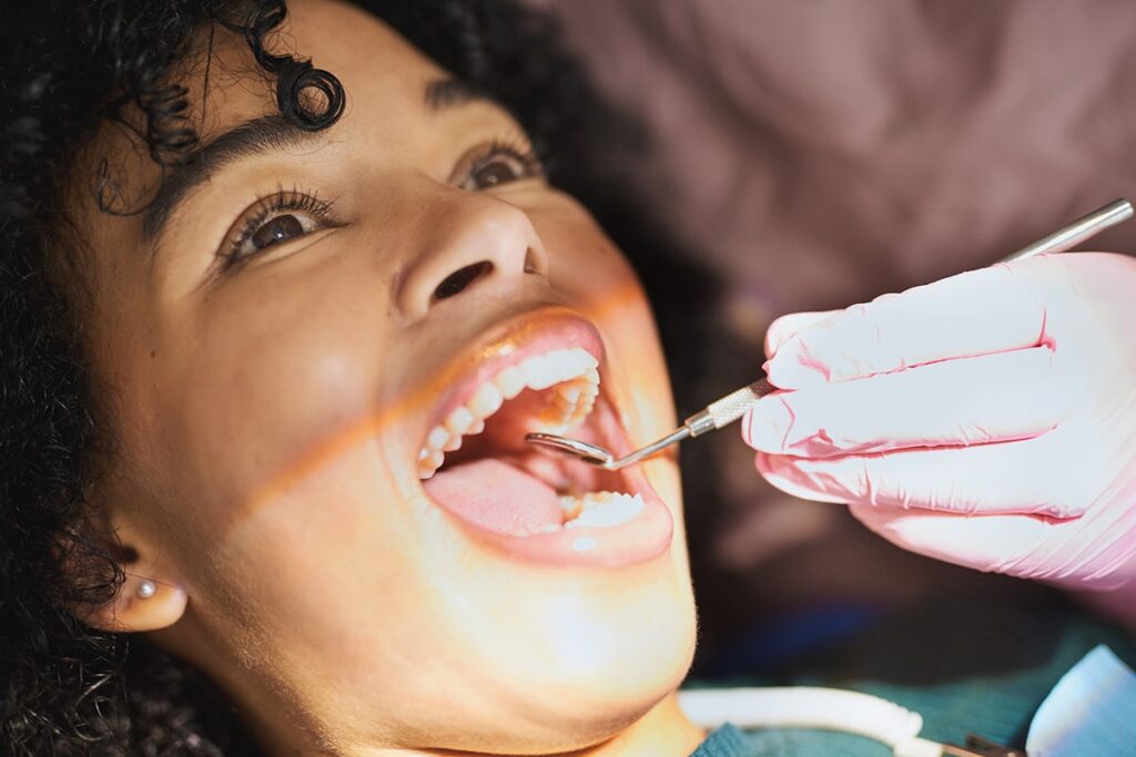 How Long Can You Go Without Getting A Root Canal?