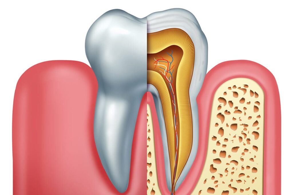 Is Endodontic Retreatment Painful