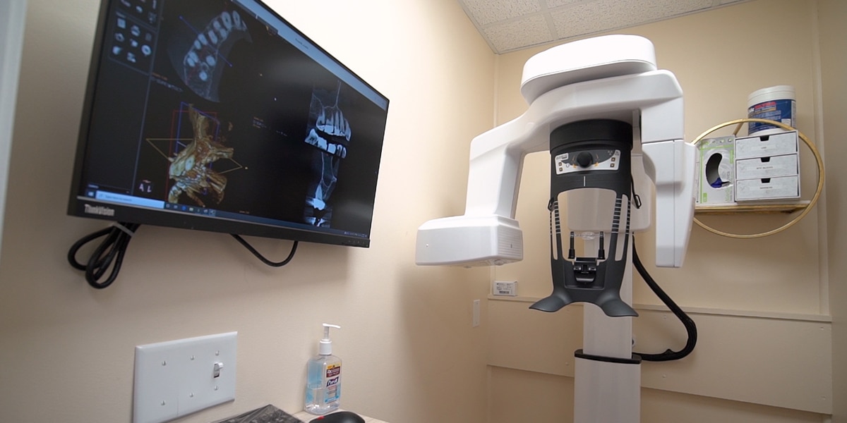 Cone Beam Scanner 3D Imaging